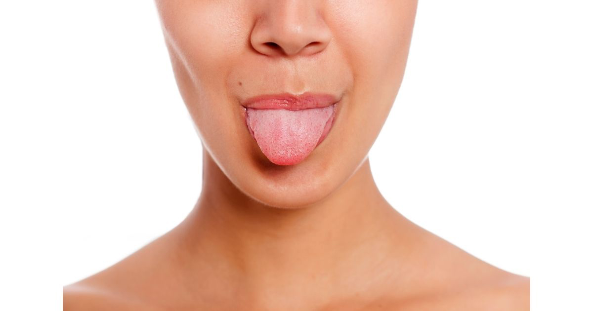 Tongue tension